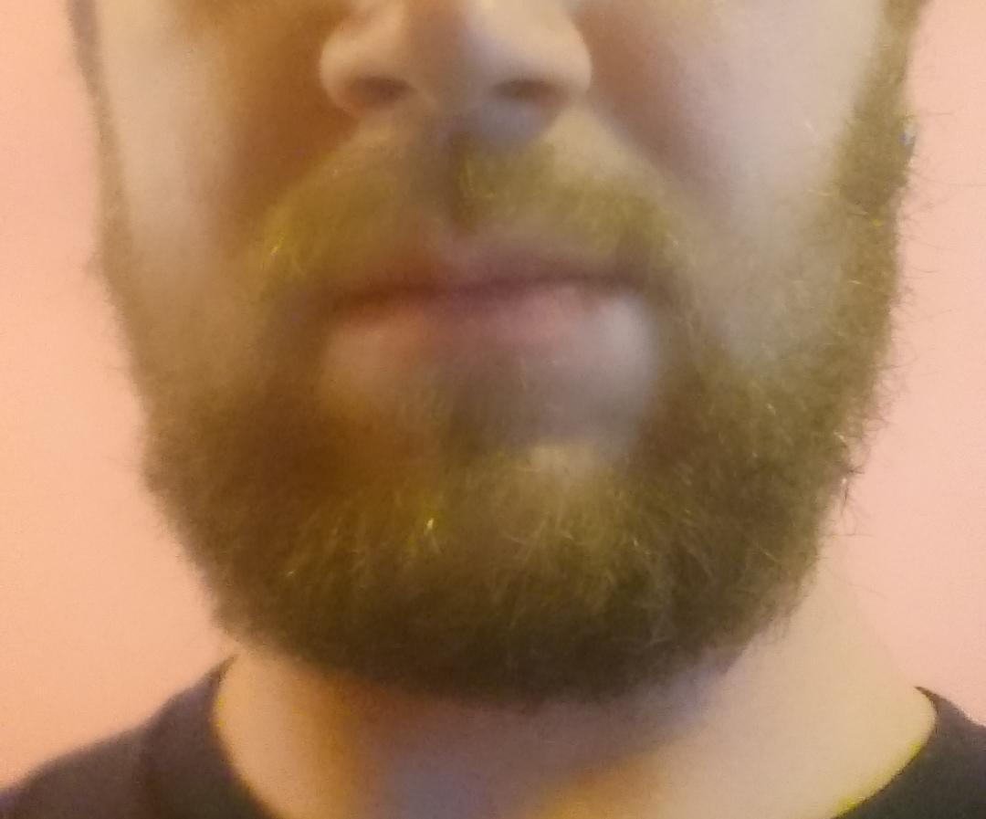 My Beard